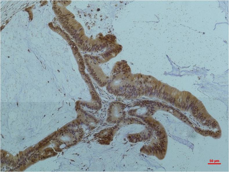 Paracletos