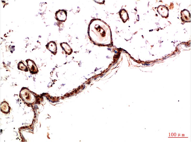Paracletos