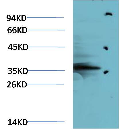Paracletos